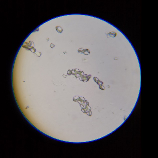 Albino-Spores