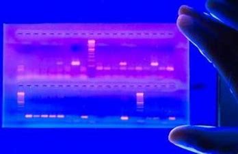 Electrophoresis Electrophoresis