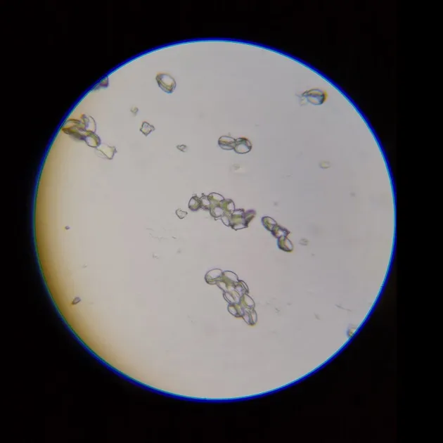 Albino Spores viewed under a microscope.