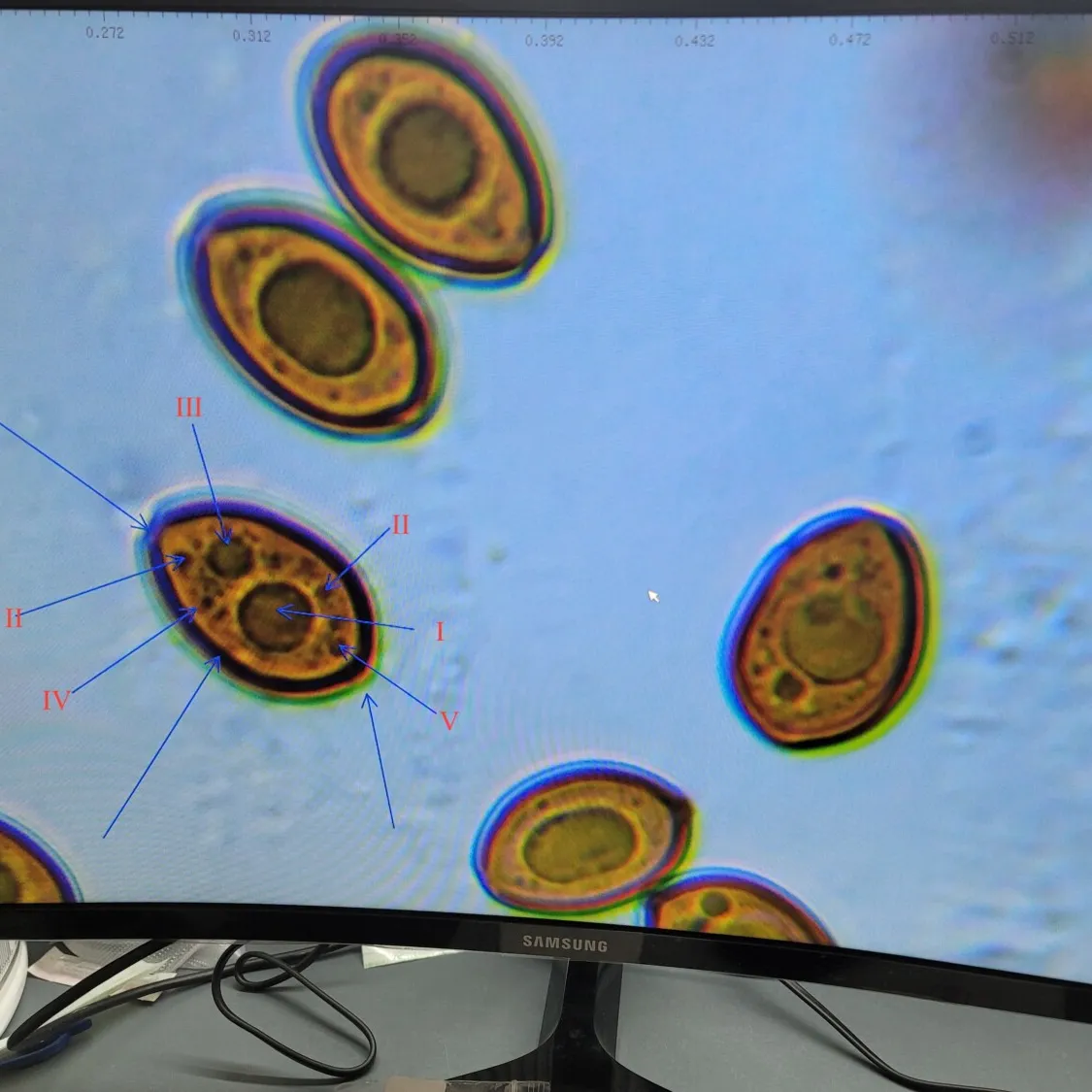 Mushroom spores under a microscope displaying their shapes and features onto a computer monitor.