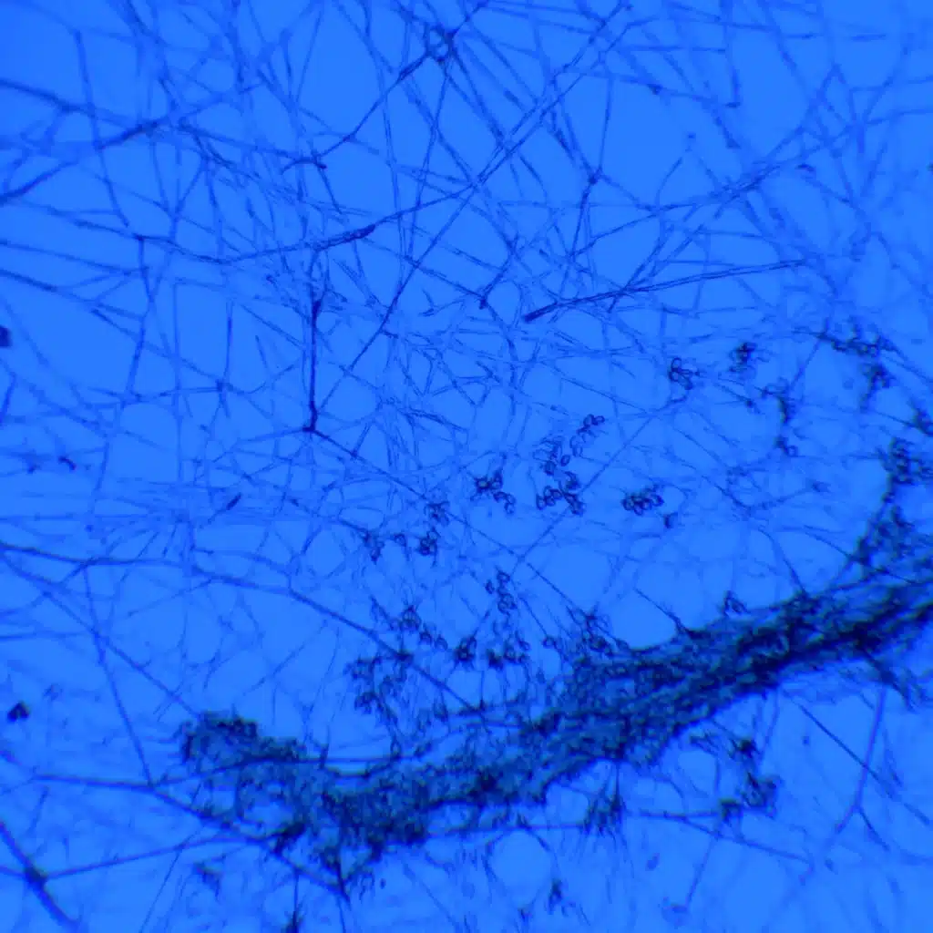 blue high contrast image of spores and mycelium at 2000X through a microscope lens. Allowing a researcher to study the finer details.