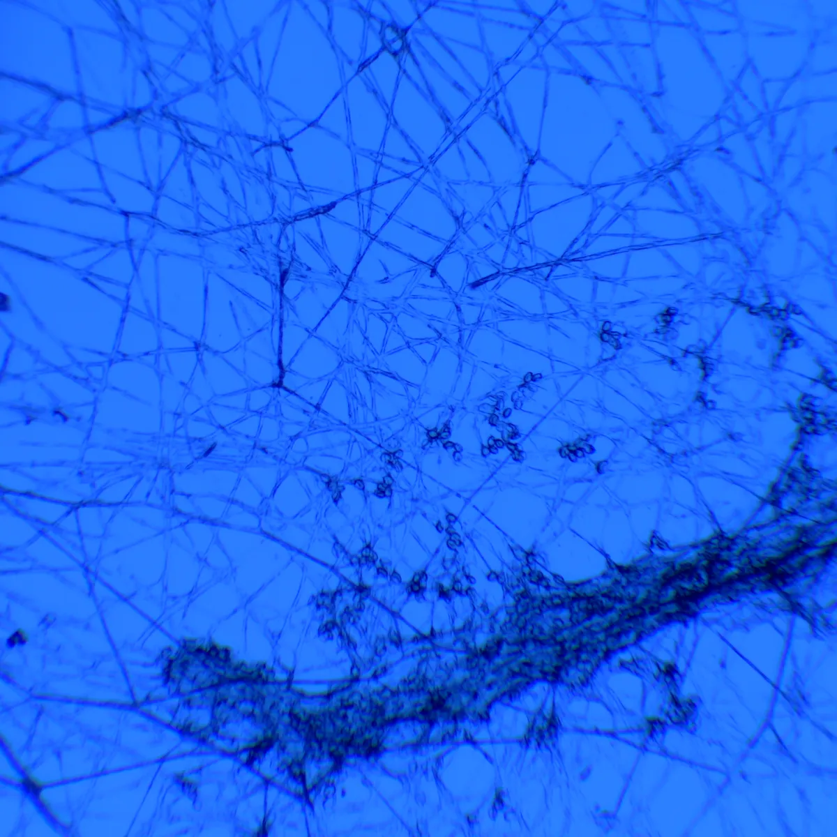 blue high contrast image of spores and mycelium at 2000X through a microscope lens. Allowing a researcher to study the finer details.