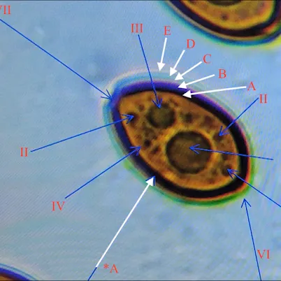 Mushroom spores under a microscope displaying their shapes, anatomy and features.