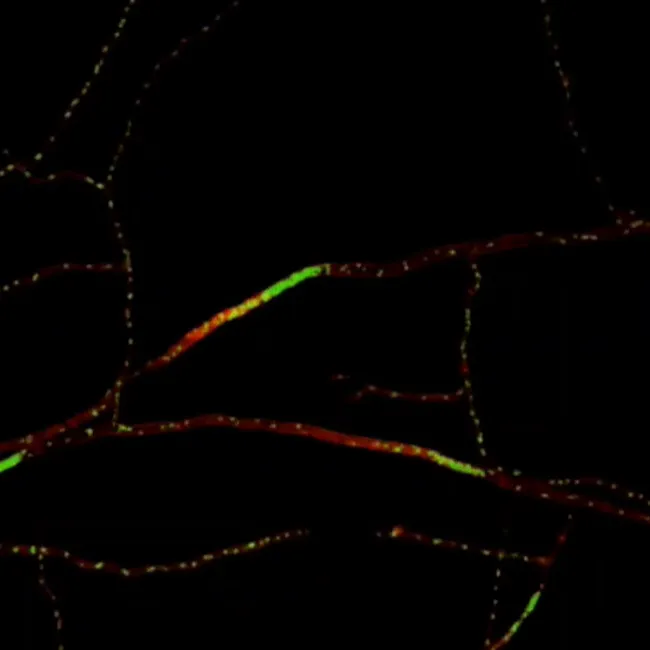 Mycelium signals running through the cytoplasm.