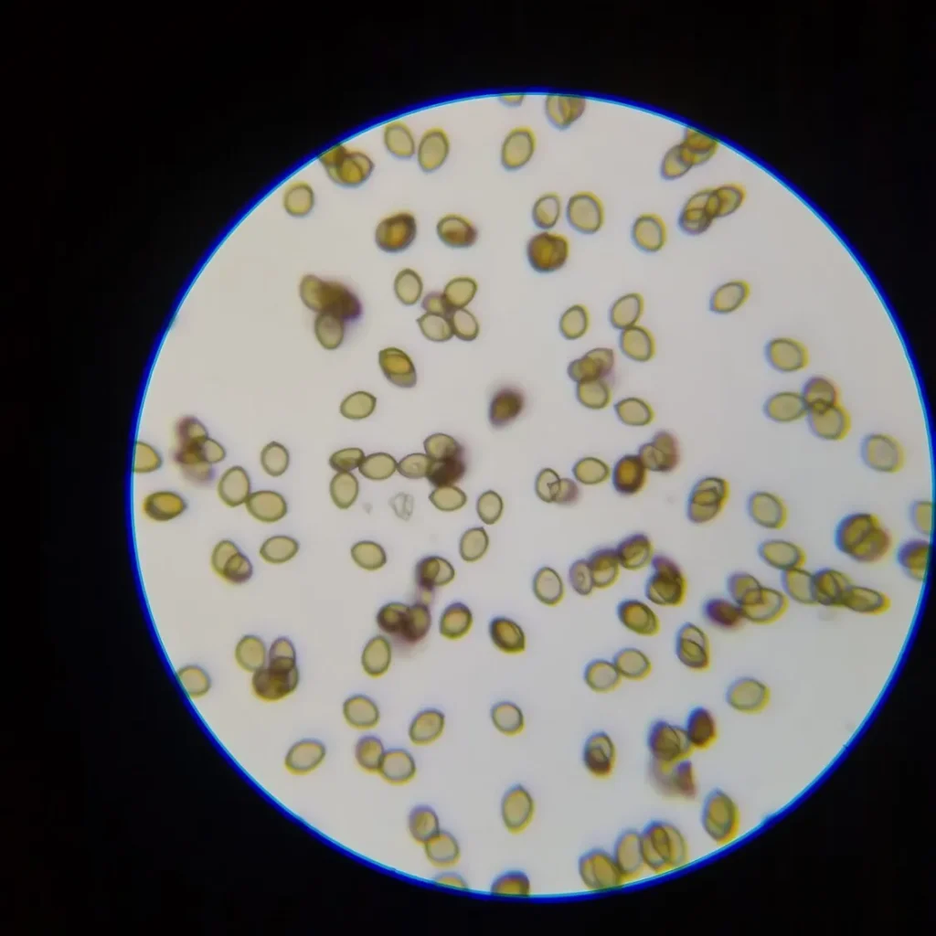 Yellow spores viewed for microscopy using a microscope.
