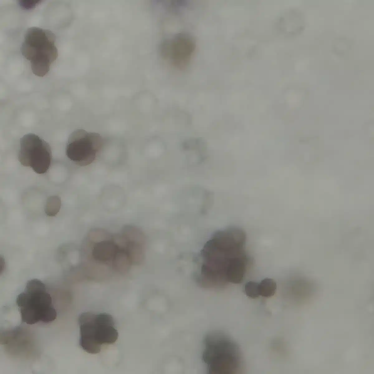 Microscopy image of spores and gill wall.